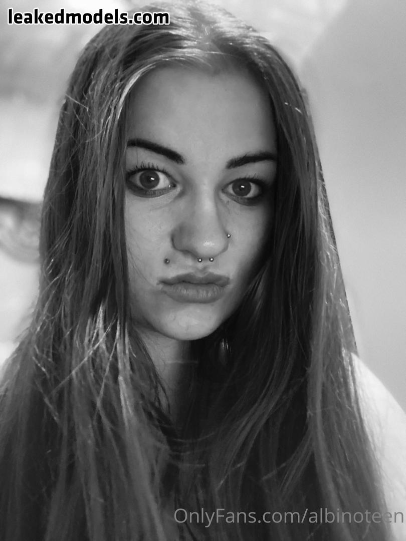 Albinoteen Naked (13 Photos) – Leakedmodels