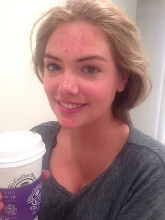 Kate Upton / Kateupton Nude Leaks Onlyfans  – Leaked Models