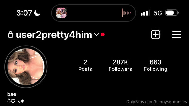 Gummygummies / Hennysgummies Nude Leaks Onlyfans  – Leaked Models